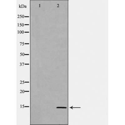 SAA1/2 Antibody