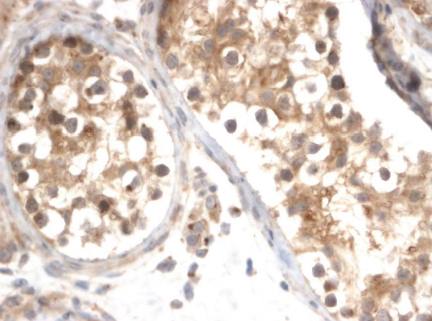 Rabbit anti Human SALL4 Antibody