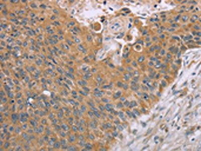 SAMD4B Antibody