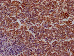 SAMHD1 Antibody