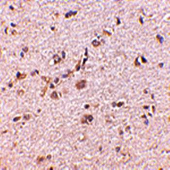 SAPAP1 Rabbit Polyclonal Antibody