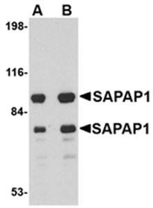 SAPAP1 Rabbit Polyclonal Antibody
