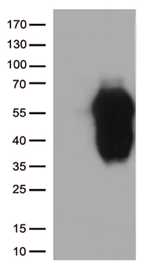 DLGAP3 Antibody