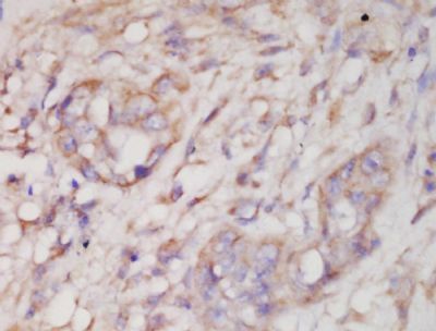 Phospho-SAPK3 (Thr183+Tyr185) Rabbit Polyclonal Antibody