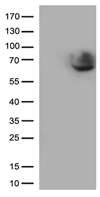 SARS-CoV-2 N Protein Rabbit Monoclonal Antibody [Clone ID: OTIR1B5]