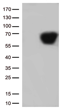 SARS-CoV-2 N Protein Rabbit Monoclonal Antibody [Clone ID: OTIR1D12]