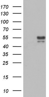 SARS-CoV-2 N Protein Rabbit Monoclonal Antibody [Clone ID: OTIR4E12]