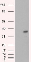 SARS-CoV-2 Spike Protein Antibody