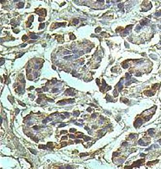 SCFD1 Rabbit Polyclonal Antibody