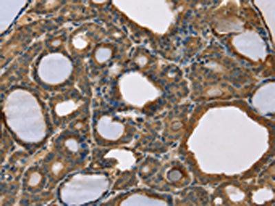 SCGB2A1 Antibody