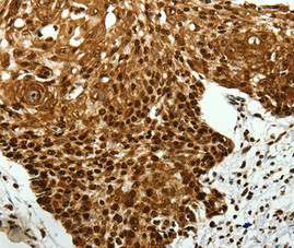 SCN11A Antibody