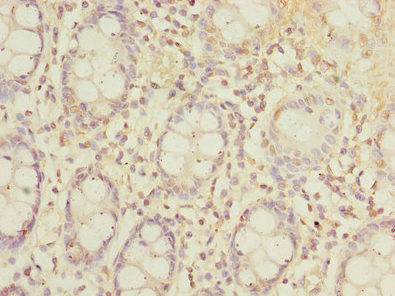SLC23A2 Antibody