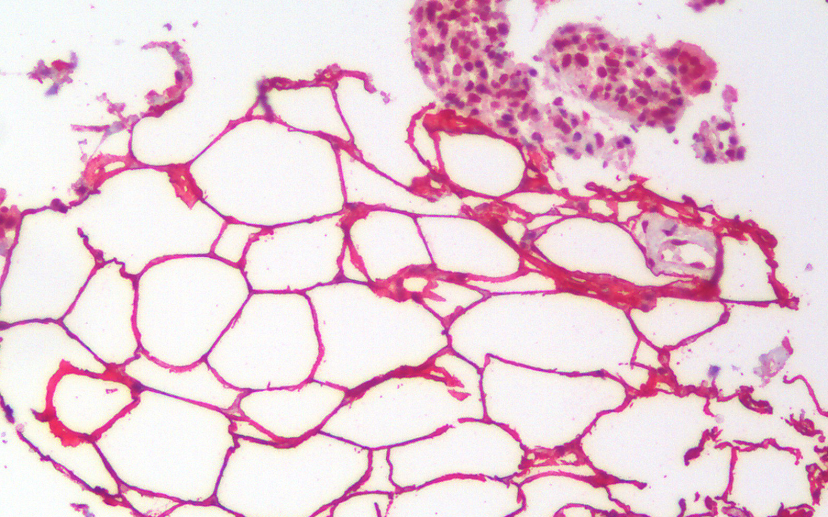 Perilipin 4 (mouse) Antibody