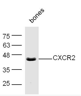 CXCR2 Rabbit Polyclonal Antibody