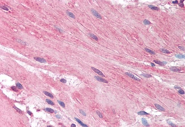 Goat anti-ACADM Antibody