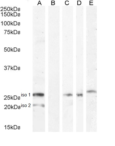 B7-H4 Antibody