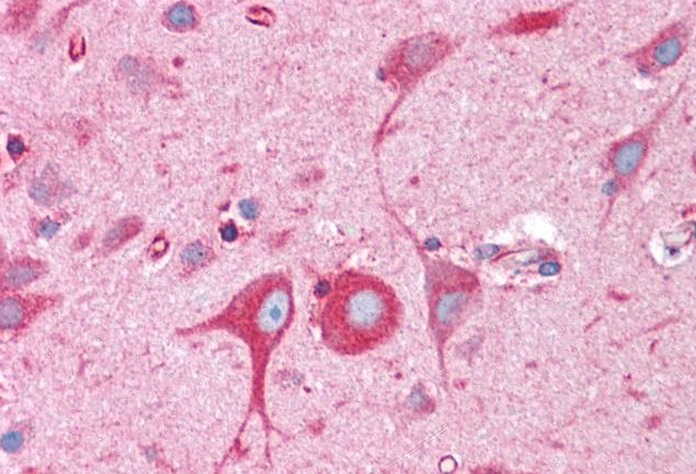 BCAP31/BAP31 Antibody