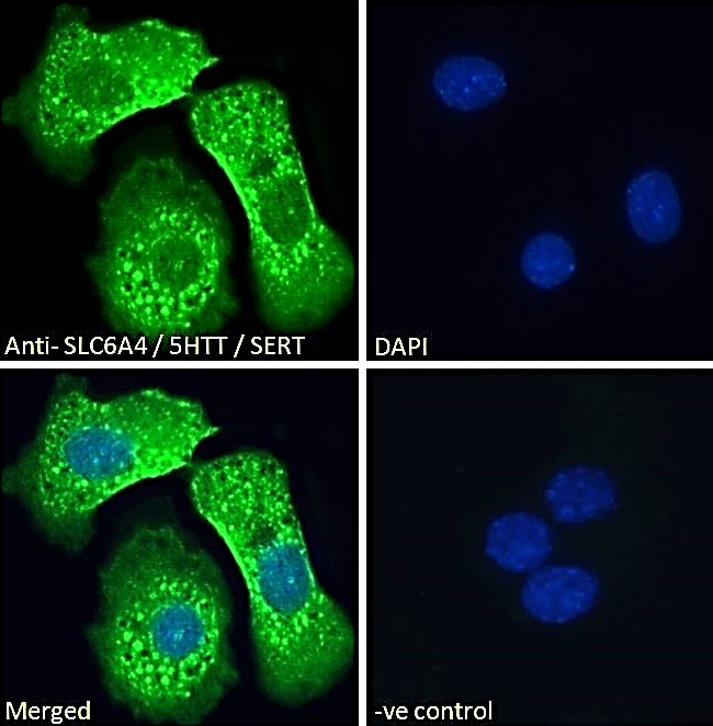 SLC6A4/5HTT/SERT Antibody