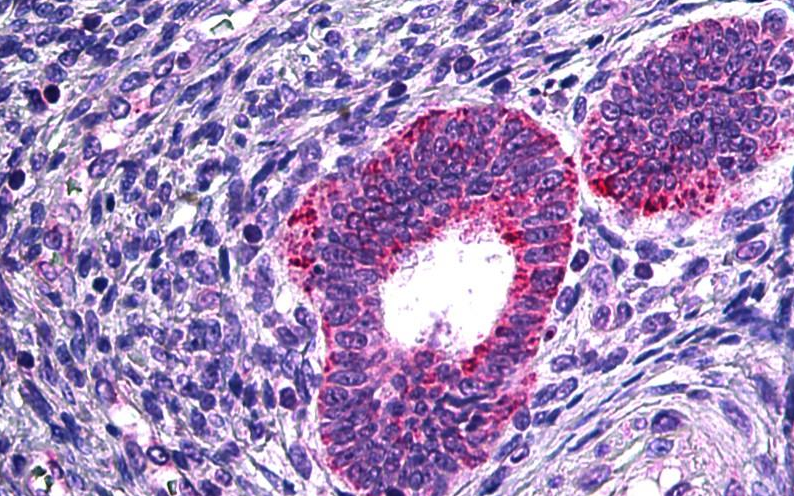 PLA2G4A Antibody