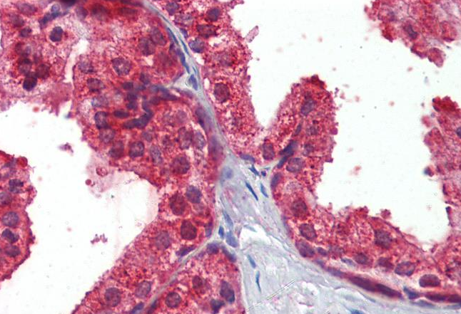 Restin/CLIP1 Antibody