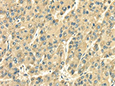 SDF4 Antibody