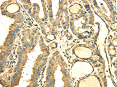 SDF4 Antibody