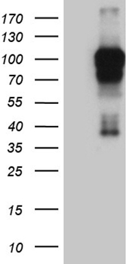 SDHB Antibody