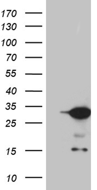 SDHB Antibody