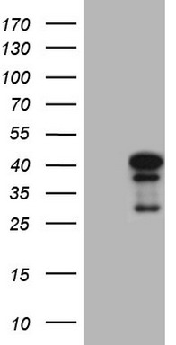 SDHB Antibody