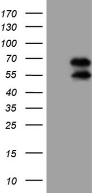 SDHB Antibody