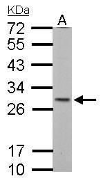 SDHB antibody [C2C3], C-term