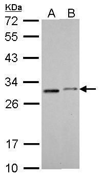 SDHB antibody [C2C3], C-term