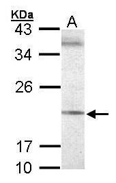 CtBP1 antibody [N3C3]