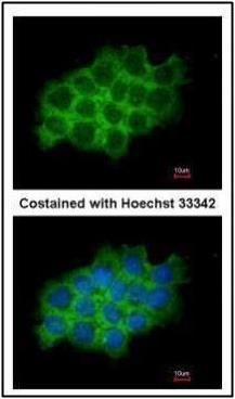 SEC61A1 Rabbit Polyclonal Antibody