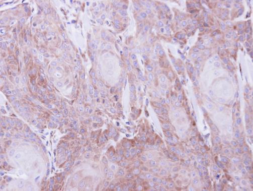 SEC61A1 Rabbit Polyclonal Antibody