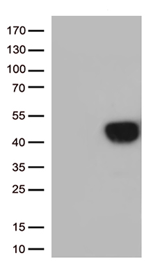 Semaphorin 4D Antibody