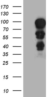 Semaphorin 4D Antibody