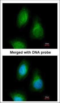 SEPHS2 Rabbit Polyclonal Antibody