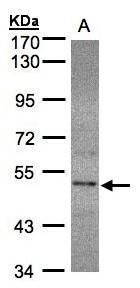 SEPHS2 Rabbit Polyclonal Antibody