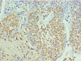 SEPT6 Antibody