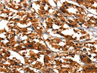 SLC6A4 Antibody