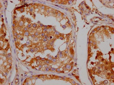 SLC6A4 Antibody