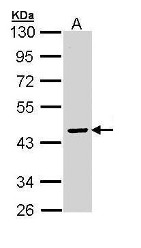 ATPase H+ transporting V0 subunit a2 Antibody