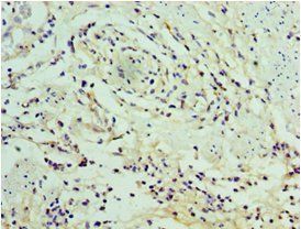 SERPINA12 Antibody