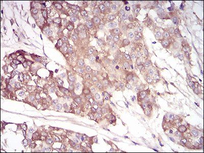 SERPINA3 Antibody