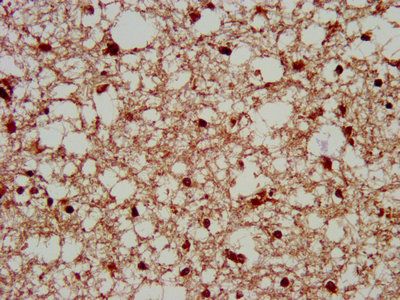 SERPINB12 Antibody