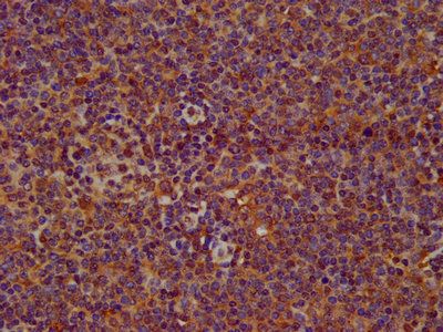 SERPINB12 Antibody