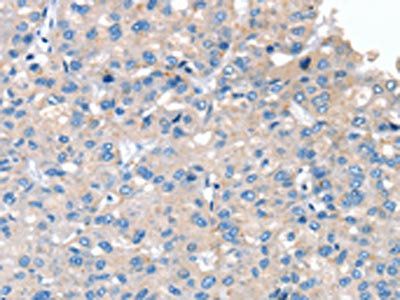SERPINB2 Antibody