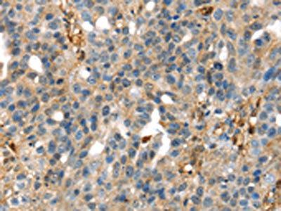 SERPINB6 Antibody