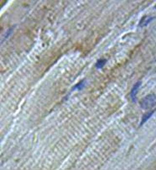 SERPINB6 Rabbit Polyclonal Antibody